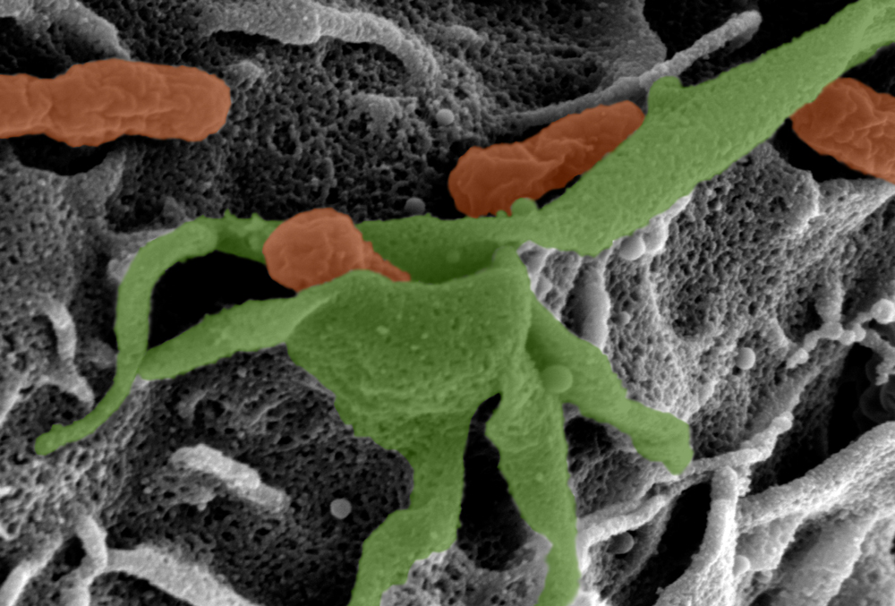 An electron microscope image of bacteria